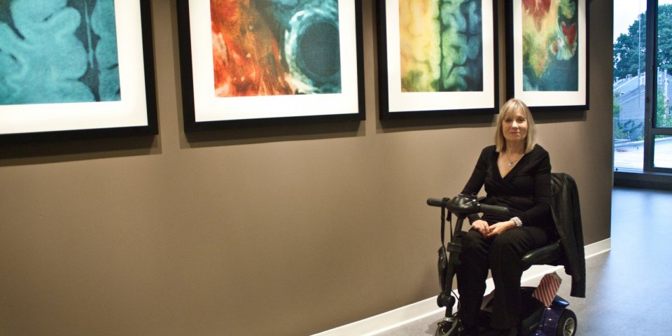 Elizabeth uses etchings of her brain scans in her artwork. All photos courtesy of Elizabeth Jameson.