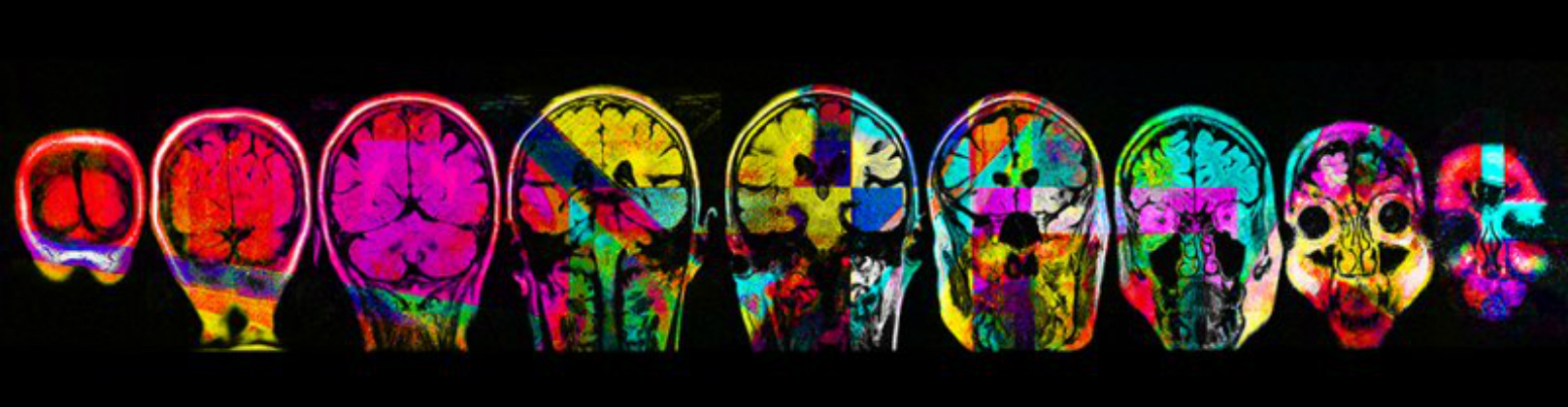 Carousel: This work charts the ups and downs of illness and what it means to live with an imperfect brain.