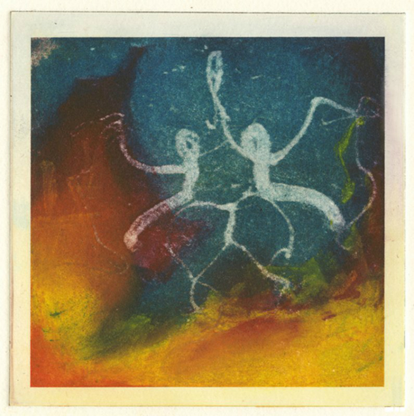 Celebration: An etching of a friend's angiogram.