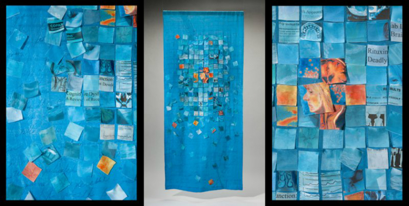 Circuitbreaker Narrative: An autobiographical tapestry that collages diary entries, medical documents, medical journals, and brains scans.