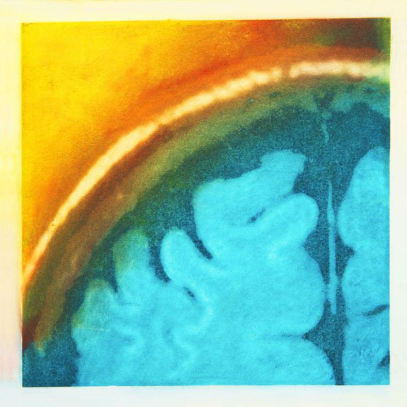 Emerging: Elizabeth sees her imperfect brain emerging out into the sunrise in this spiritual image.