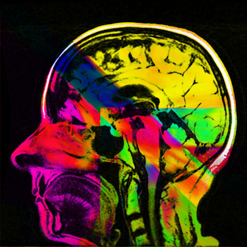 Neuroplasticity: Digital collage of Elizabeth's MRIs.