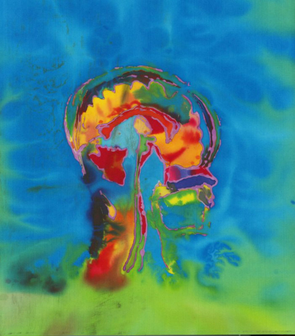 Self-Portrait: Silk painting inspired by Elizabeth's MRIs, celebrating the imperfection of illness and disability.
