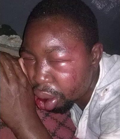 Mr Olalowo; the victim of a cruel tradition