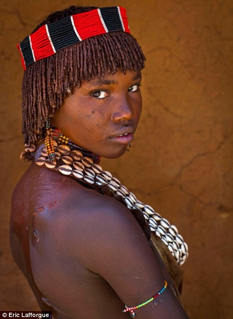Young Hamar Women Show The Physical Effects Of Being Whipped