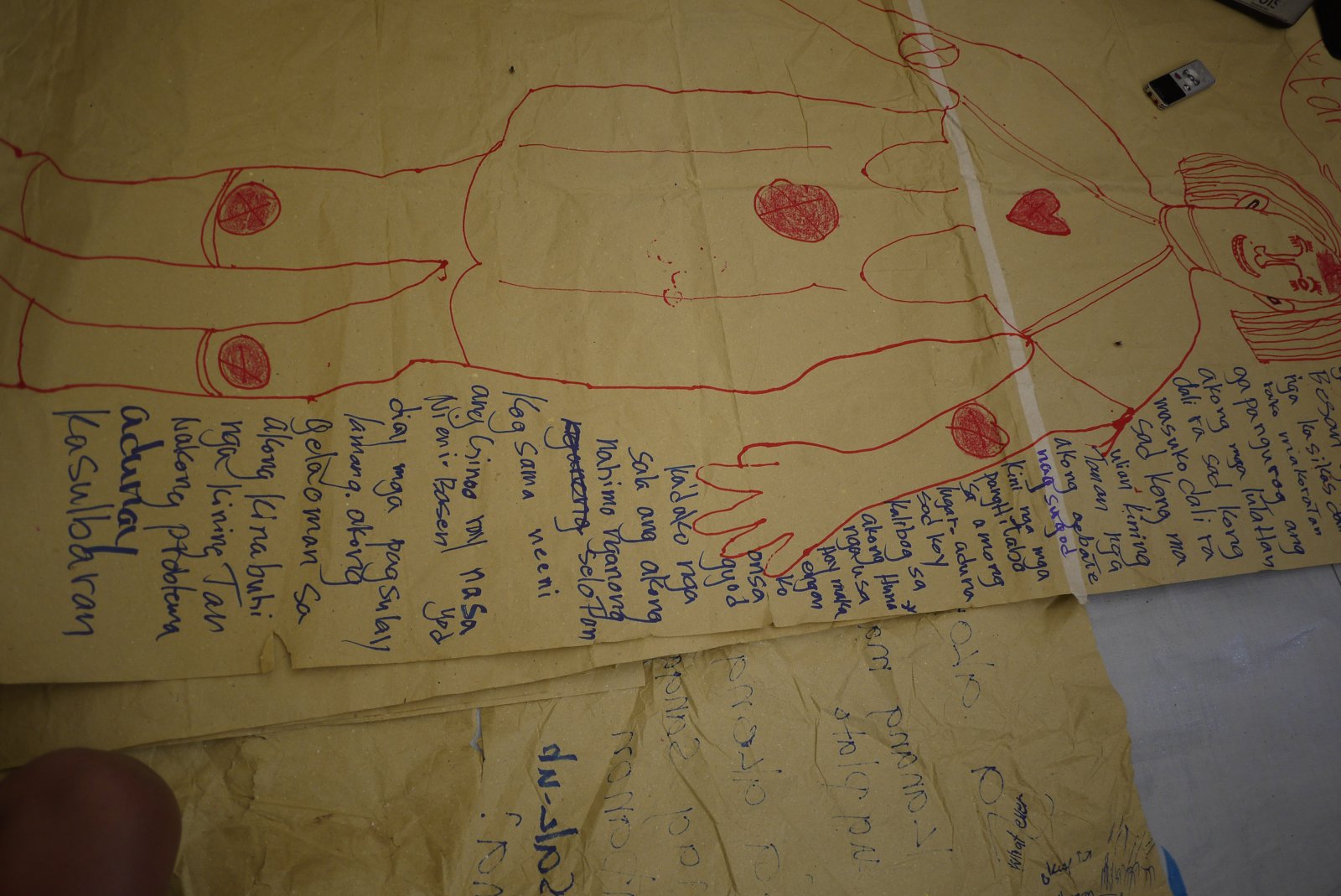 A body map is festooned with red circles marking the painful parts of the body. Photo courtesy of MIILS