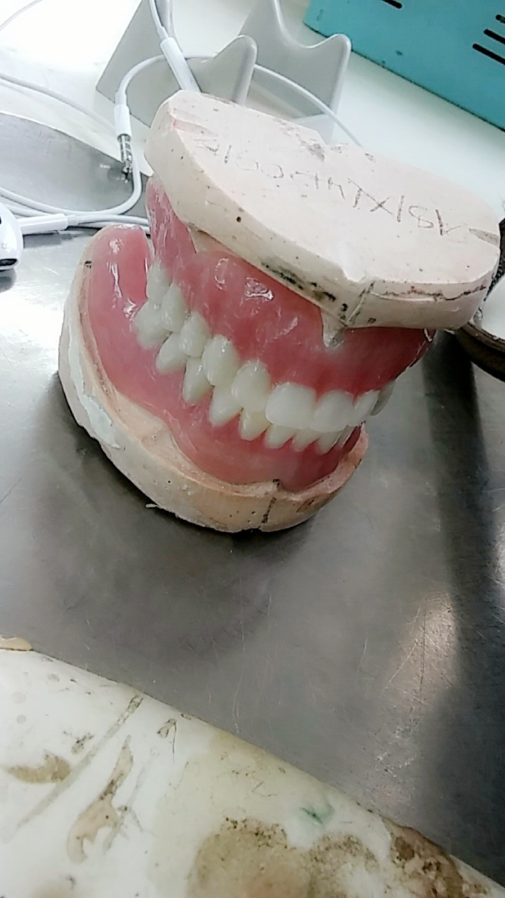 It is used to cover all edentulous areas in the patients mouth ar can be removed by the patient